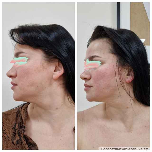 Ручной массаж "Золотые ручки мастера"