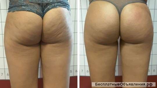 Модель на идеальное тело за 30 дней