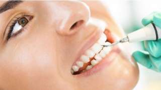 Ультразвуковая чистка зубов