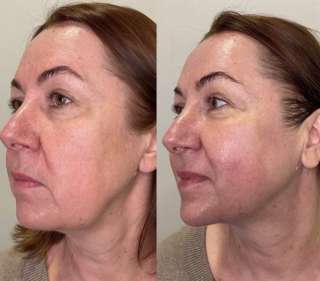 Салон CloudBeauty ищем моделей на смас лифтинг