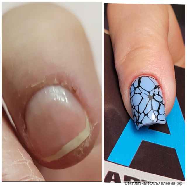 Комбинированный маникюр