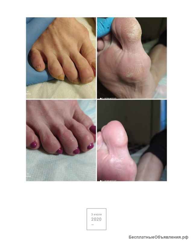 Маникюр и педикюр