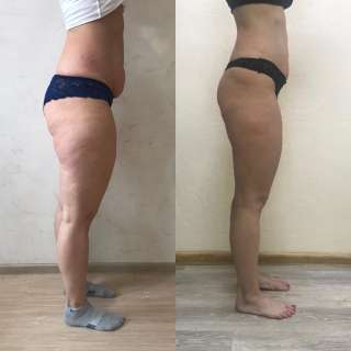 Коррекция фигуры