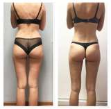 Массаж лечебный