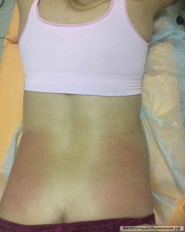 Массаж лечебный