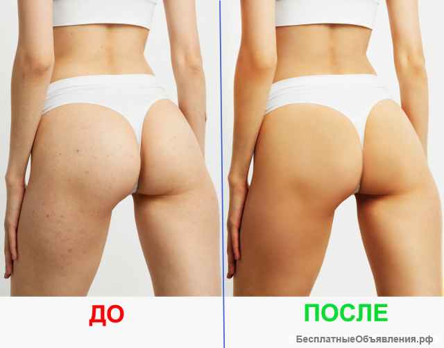 Обработка фото за 20 рублей