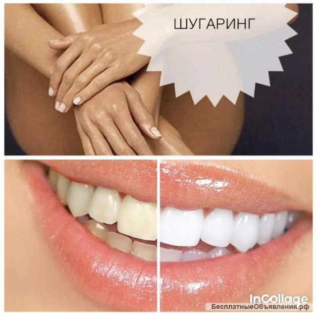 Шугаринг/ Отбеливание зубов