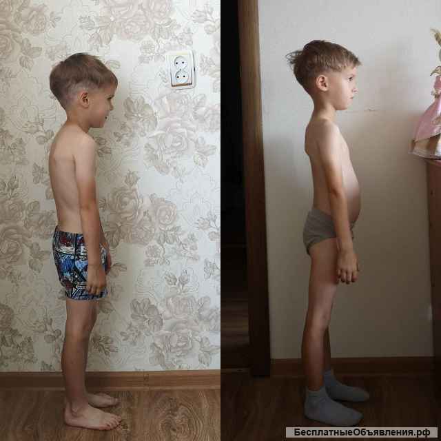 Остеопластика, миофосоциальный массаж