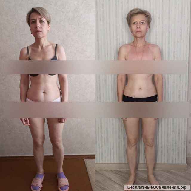 Остеопластика, миофосоциальный массаж