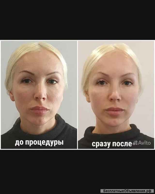 Модель бесплатно