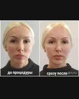Модель бесплатно