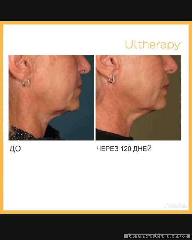 Модель бесплатно