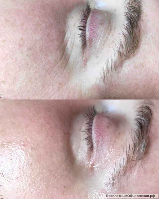 Массаж лица и тела