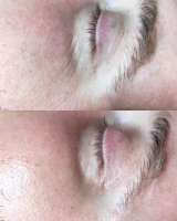 Массаж лица и тела