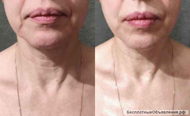 Массаж лица и тела