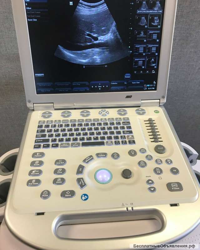 Mindray M7 Ultrasound Machine