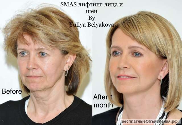 SMAS и RF лифтинг, Лазерная эпиляция, Кавитация, Вакуумный массаж