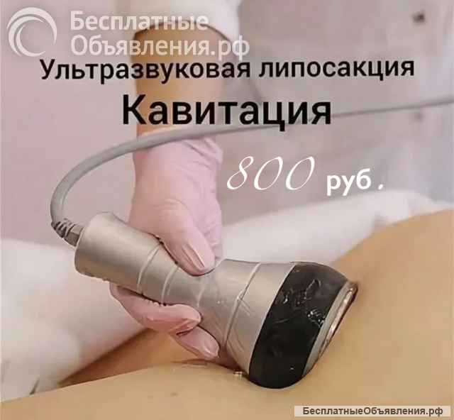 SMAS и RF лифтинг, Лазерная эпиляция, Кавитация, Вакуумный массаж