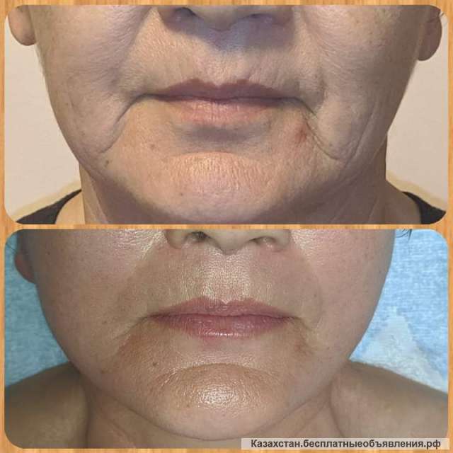 Профессиональный массаж Алматы