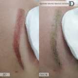 Бесплатно - ТРЕБУЮТСЯ МОДЕЛИ ДЛЯ УДАЛЕНИЯ/ ПЕРЕКРЫТИЯ ПМ