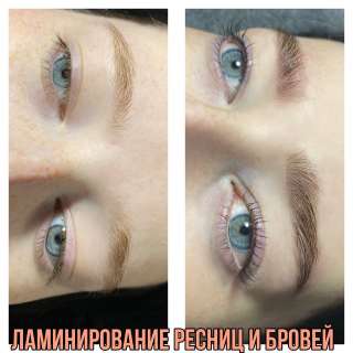 Косметология. Шугаринг 17;22;29 марта всё по 500