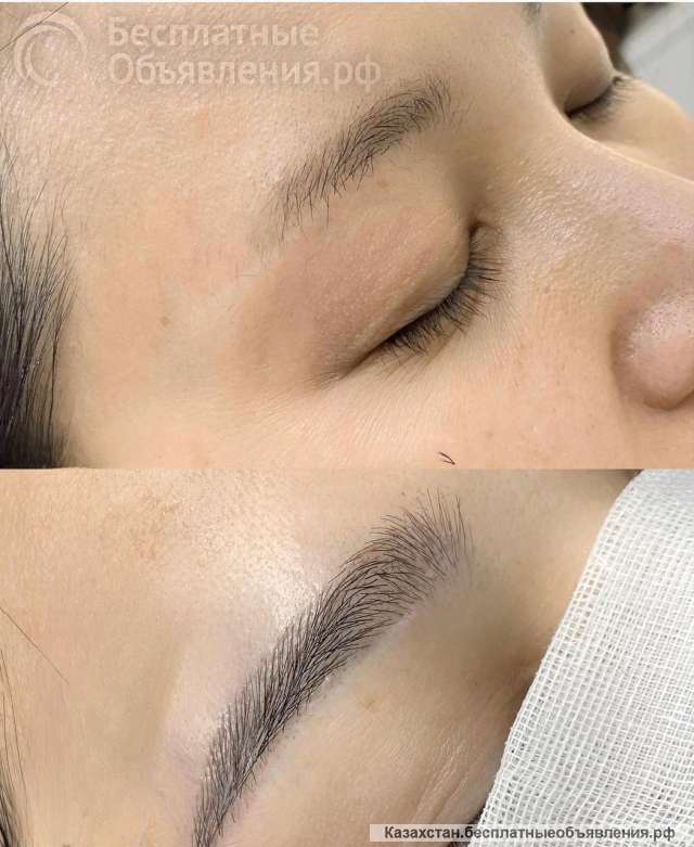 Станьте мастером пересадки бороды