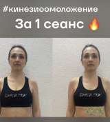 Массаж лица