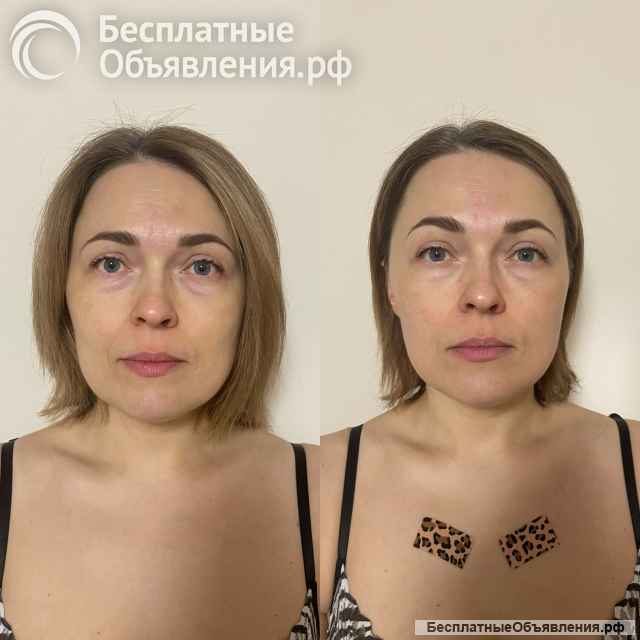 Массаж лица