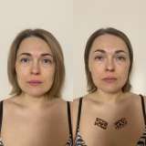 Массаж лица