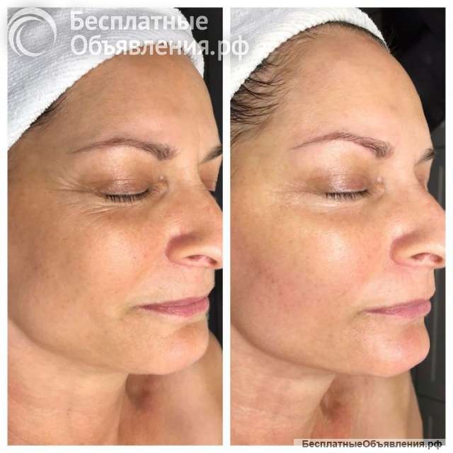 Массаж лица косметолог Ялта