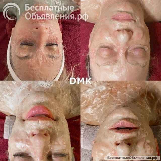 Массаж лица косметолог Ялта