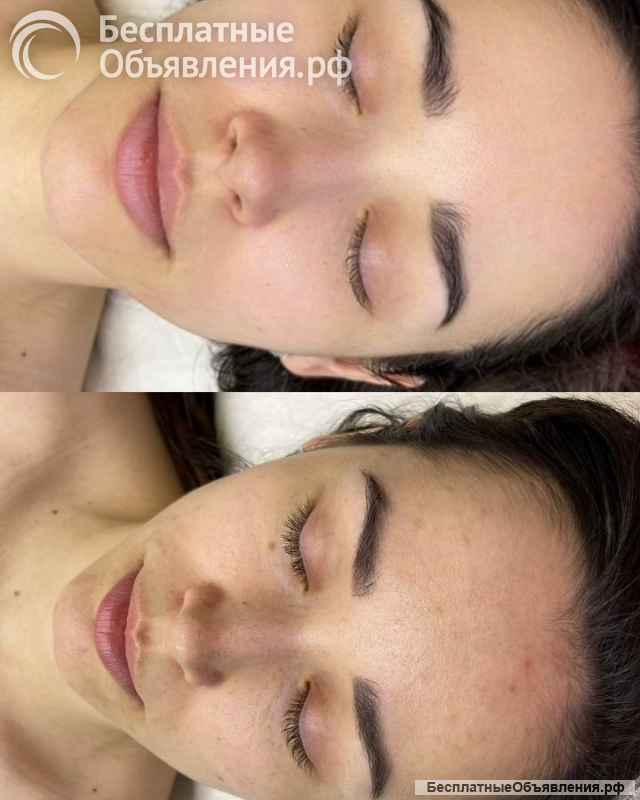 Массаж лица косметолог Ялта