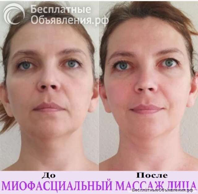 Миофасциальный массаж лица, груди, шеи, зоны декольте