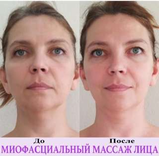 Миофасциальный массаж лица, груди, шеи, зоны декольте
