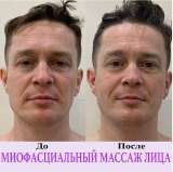 Миофасциальный массаж лица, груди, шеи, зоны декольте