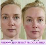 Миофасциальный массаж лица, груди, шеи, зоны декольте