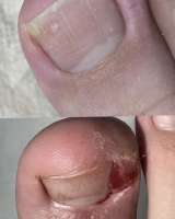 Маникюр. Педикюр