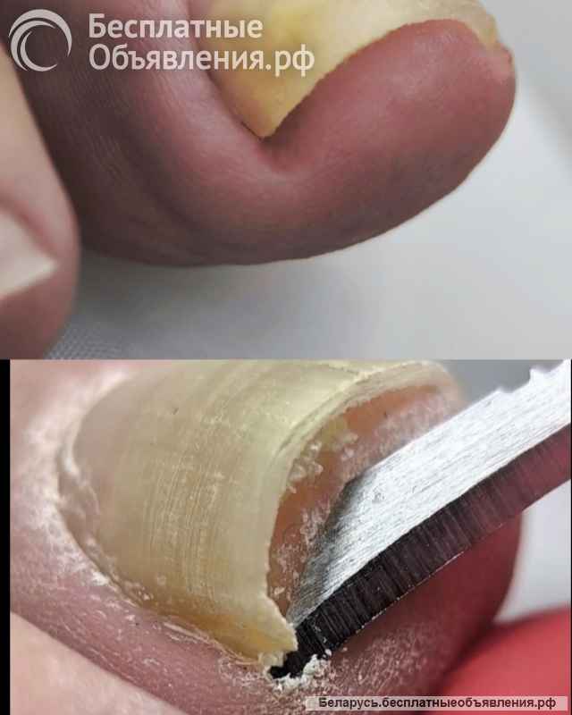 Маникюр. Педикюр