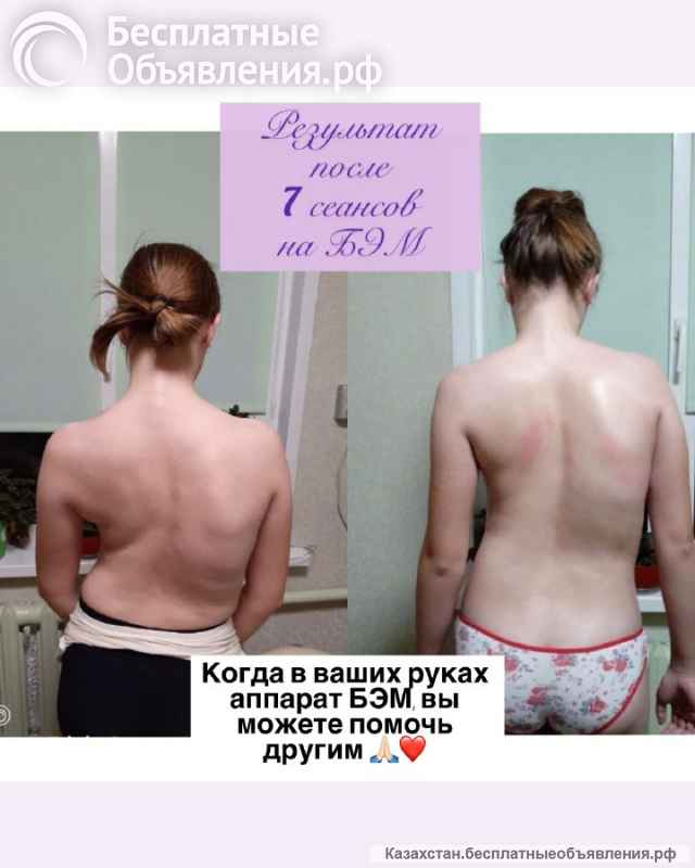 ОРГАНЫ под защитой БИОЭНЕРГИИ