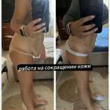 Экспресс похудение от -3 до -24см за 1 сеанс