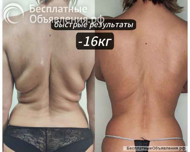 Экспресс похудение от -3 до -24см за 1 сеанс