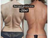 Экспресс похудение от -3 до -24см за 1 сеанс