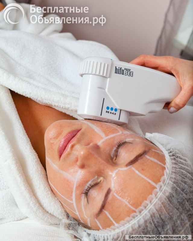 SMAS-лифтинг 8000 вместо 40 000