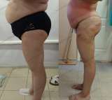 Коррекция фигуры