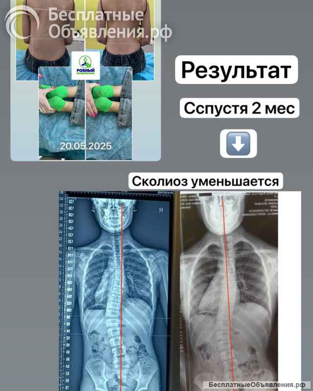 Оздоровительный массаж