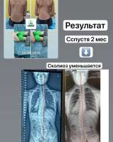 Оздоровительный массаж