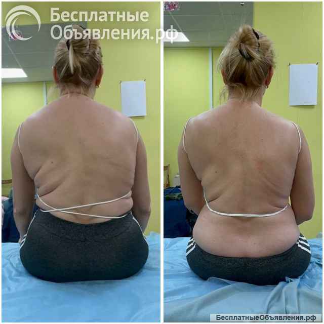 Оздоровительный массаж