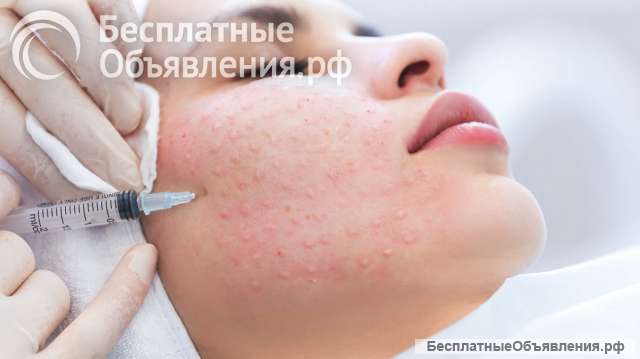 Мезотерапия и биозавивка