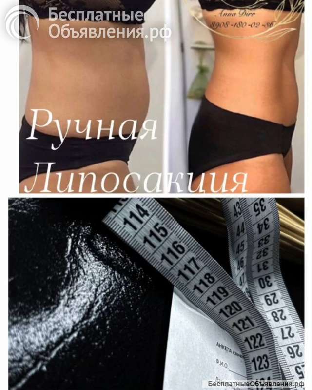 Ручная липосакция 5в1