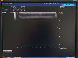 Линейный датчик УЗИ Esaote LA523